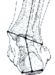 pronation